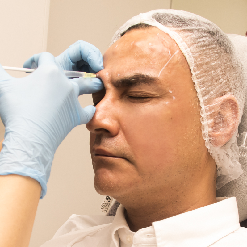 Dermatoxin Allergan