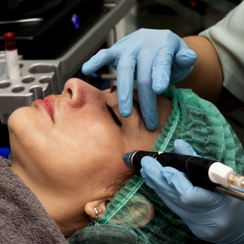 Hydrafacial Platinum Acne - Face